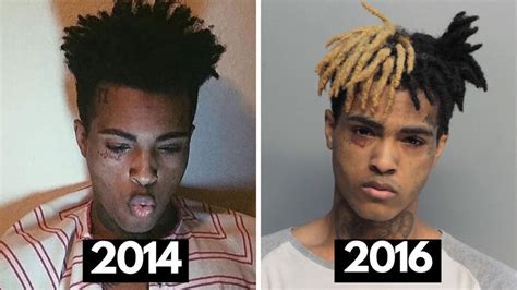 XXXTentacion Dreads Evolution | Heartafact