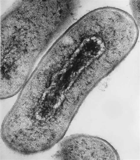 What Can Electron Microscopy Do for You?