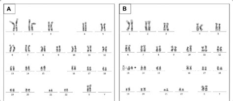 Cytogenetic karyotype from cultivated lymphocytes previously stimulated... | Download Scientific ...