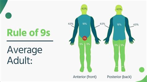Rule of 9s and Burn Center Criteria for EMS - YouTube
