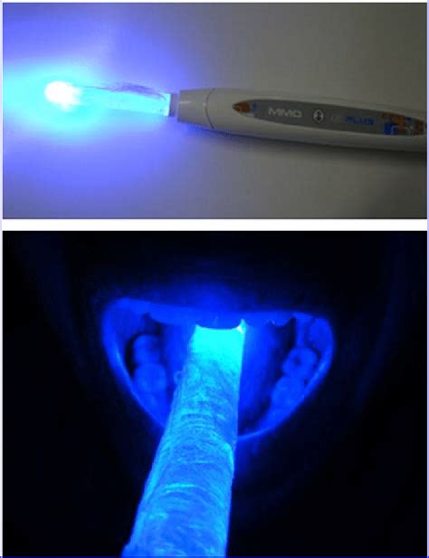 New blue light-emitting diode (LED) device for photodynamic therapy ...