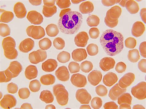 Differential Quik III Stain Kit