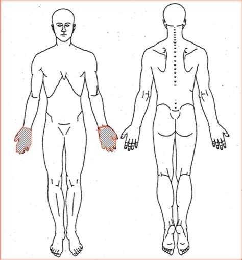 The pain drawing used for this study. | Download Scientific Diagram