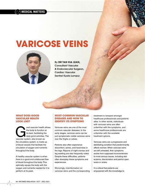 Varicose Veins - CVSKL