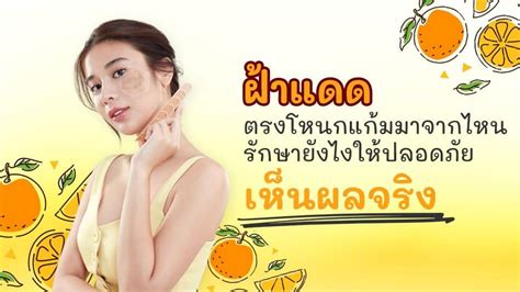 ฝ้าแดด'เกิดจากอะไร พร้อมแชร์และบอกต่อวิธีรักษาแบบเห็นผลจริง!