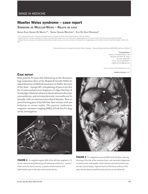 (PDF) Mueller Weiss syndrome--case report