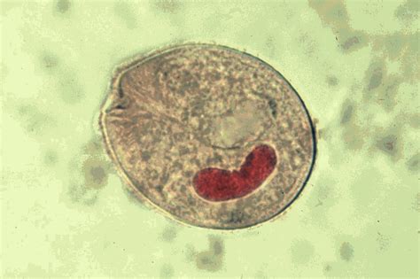 Balantidium Coli Trophozoite