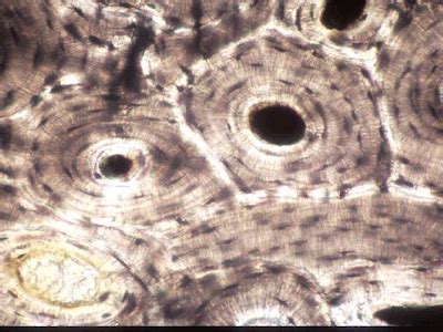 Histology Slides: Bone Tissue (Osseous)