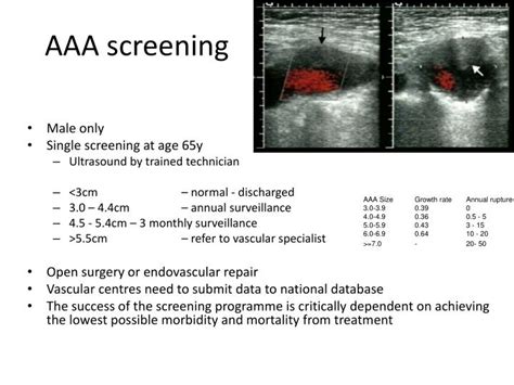 PPT - Abdominal Aortic Aneurysm PowerPoint Presentation - ID:3143348