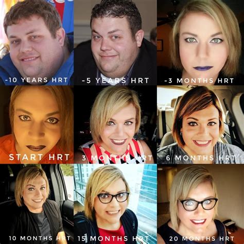 40 YO MTF Transition Timeline - lost 100lbs and started HRT at 39YO ...