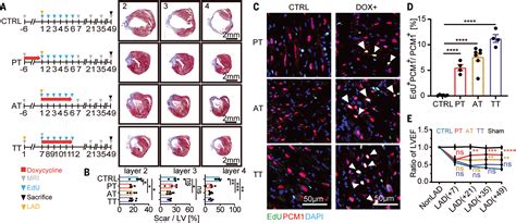 Reversible reprogramming of cardiomyocytes to a fetal state drives heart regeneration in mice ...