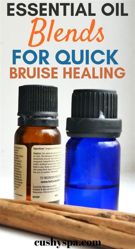 5 Essential Oils for Bruises and How to Use Them (With images) | Essential oils for massage ...