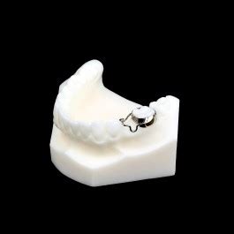 Band and Loop Space Maintainer :: Great Lakes Dental Technologies