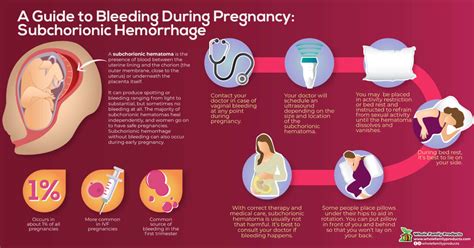 Subchorionic Hemorrhage, Symptoms, Causes, Bleeding During Pregnancy: A ...