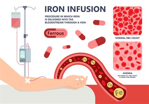 Iron Deficiency - Parsemus Foundation