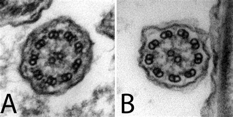 Cilia ultrastructure observed by transmission electron microscopy. (A)... | Download Scientific ...