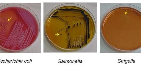 Salmonella-Shigella (SS) Agar: Composition, Principle, Procedure and Results - Learn ...