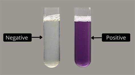 Biuret Test For Protein Principle, Procedure, Result, Application ...