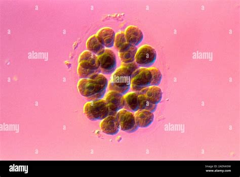 Pandorina. Light micrograph of a cluster of cells of Pandorina ...