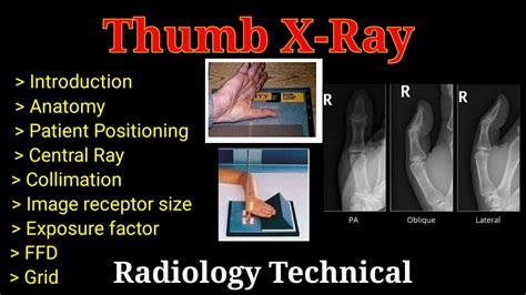 Thumb X-Ray # Thumb AP # Thumb Lateral # oblique view # Upper limb ...