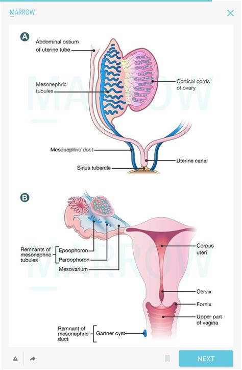 Embryology of female reproductive system in 2022 | Female reproductive ...