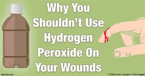 Hydrogen Peroxide & Wounds | Ramsey, NJ Patch