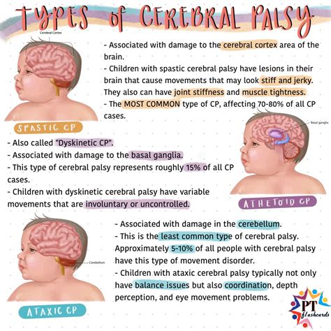 Athetoid Cerebral Palsy