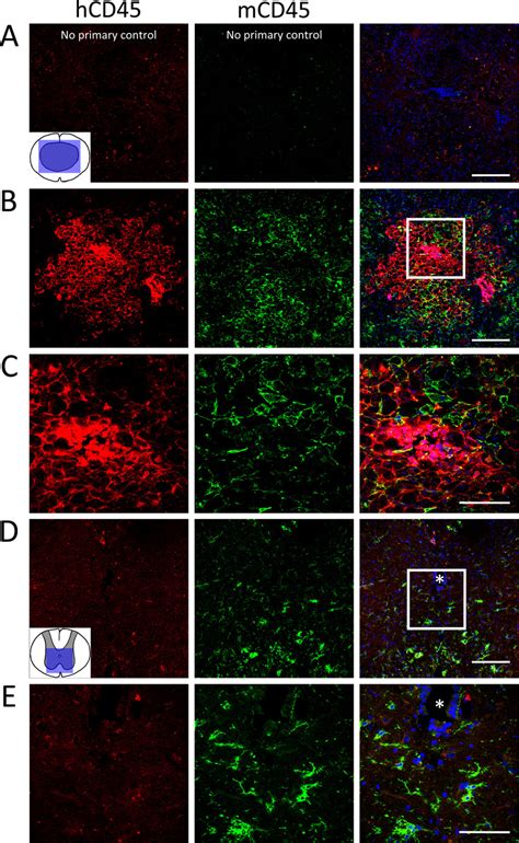 Human CD45 + (hCD45) immune cells are restricted to the lesion ...