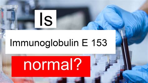 Is Immunoglobulin E 153 normal, high or low? What does IgE level 153 mean?