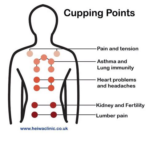 Cupping Points, Acupuncture Points Chart, Hijama Cupping, Fire Cupping ...