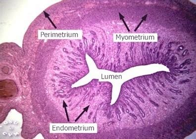 Week 13 Exam 3 (Female Reproductive System) Flashcards | Quizlet