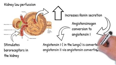 Renal Artery stenosis - simply explained under 2 minutes - YouTube