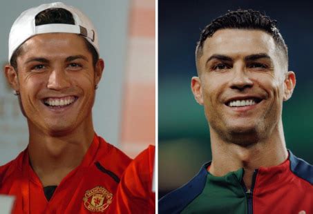 Are Ronaldo's Teeth Really His Own? Find Out The Truth | Longevita