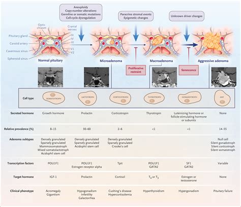 Pituitary-Tumor Endocrinopathies | NEJM