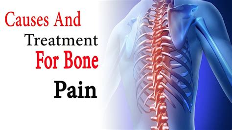 Bone Pain: Causes, Symptoms and Natural Treatment | Best Herbal Health