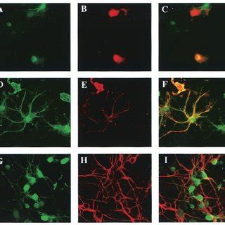 Gene transduction into primary mouse osteoblast (left) and osteoclast... | Download Scientific ...