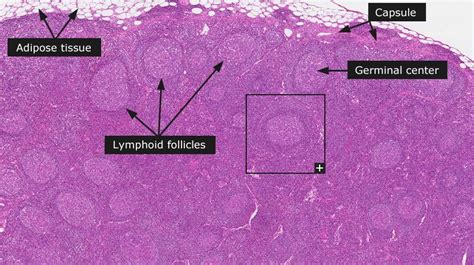 Dictionary - Normal: Lymph node | Histología, Biología, Fotografia