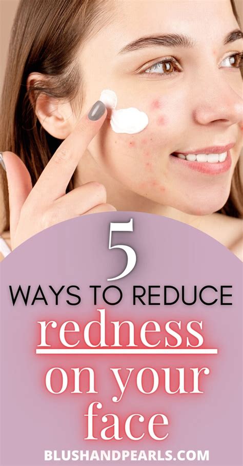 5 Ways To Manage Facial Redness Blush & Pearls