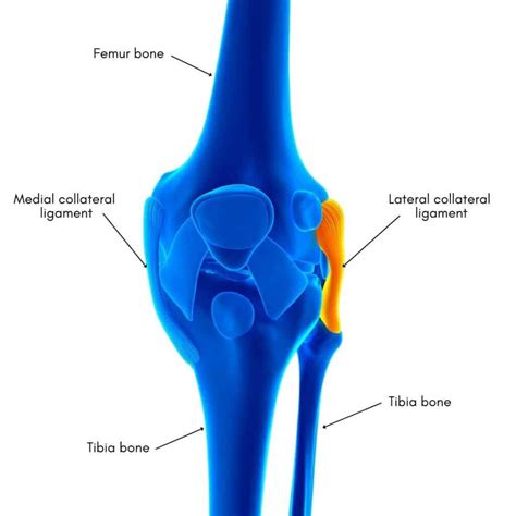 LCL Injury | Lateral Collateral Ligament Injury of the Knee