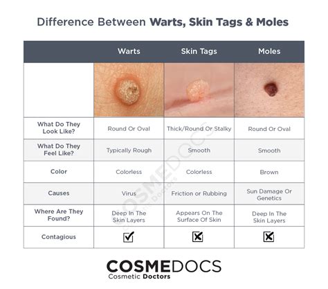 Difference Between Genital Warts And Skin Tags