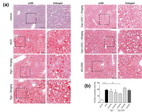 Oil red O staining of liver sections from the control and MCD-induced ...