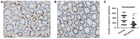 Somatostatin-positive-cells (arrows) in (A) a healthy control and in ...