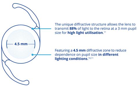 AcrySof IQ PanOptix Trifocal IOL | MyAlcon | International