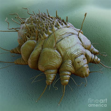 Scabies Mite Photograph by Science Picture Co