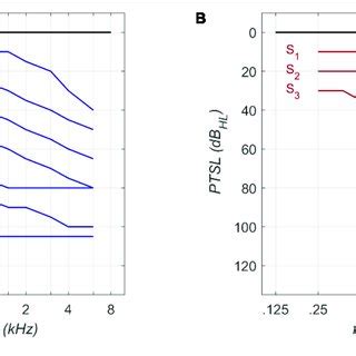 | Audiogram types according to Bisgaard et al. (2010) for flat (A) and... | Download Scientific ...