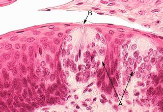 Oral Histology Digital Lab: Mucosa: High Power of Taste Bud (Image 27)