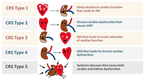 cardiorenal syndrome acute kidney injury