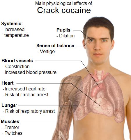 The Health Effects of Cocaine | bharath's blog