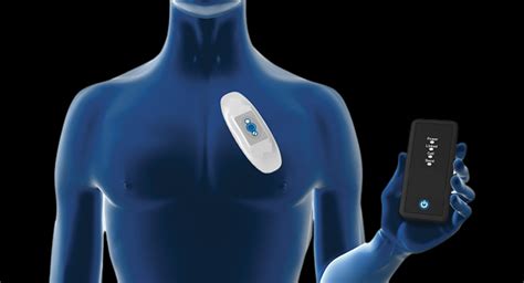 Cardiac arrhythmia monitoring devices market to surpass USD 10.3B – Medical Buyer