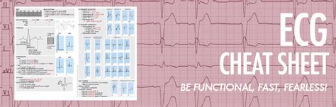 ECG Cheat Sheet! – Henry Del Rosario's Art Portfolio and Medical Blog